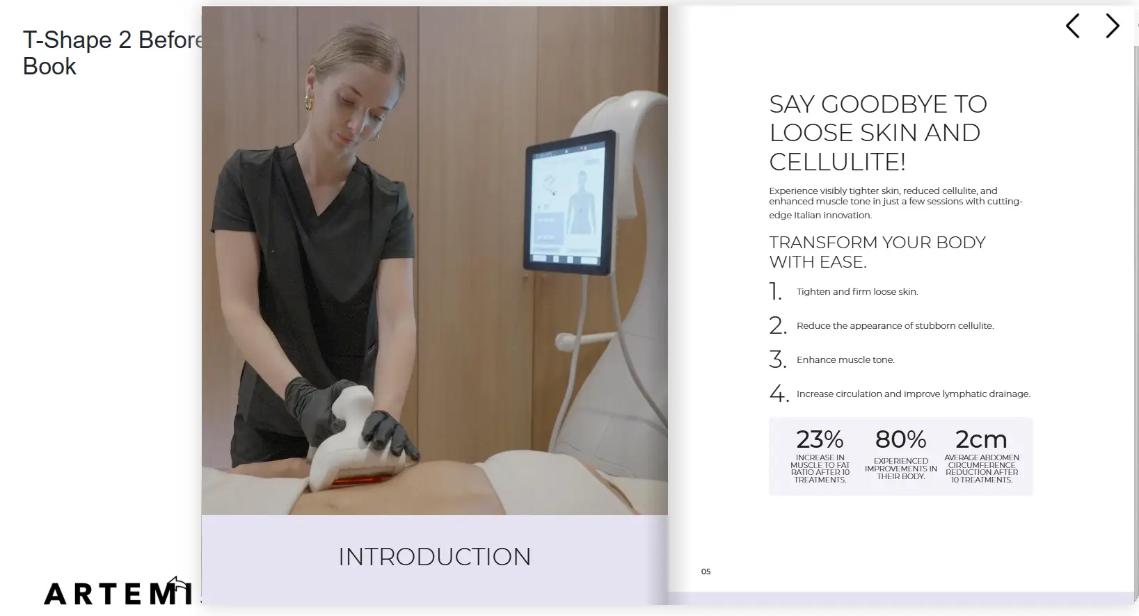 A therapist performing a cellulite treatment on a patient's thigh using a modern device.